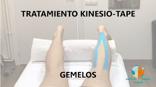 Aplicación del kinesiotape en gemelos [upl. by Enenej]