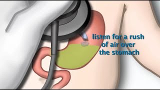 Nasogastric Tube Placement by S Hamilton  OPENPediatrics [upl. by Undine105]