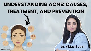 Understanding Acne Causes Treatment and Prevention  By Dr Vidushi  SkinInspired [upl. by Mellisent]