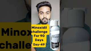 Minoxidil challenge for 90 DaysDay49 minoxidilresult minoxidil viralreels viralshorts hair [upl. by Dilan]