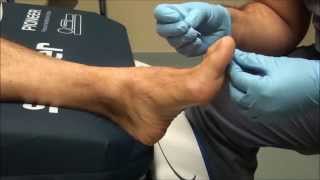 Neurologic Examination of the Foot Pin Prick Testing [upl. by Cod167]