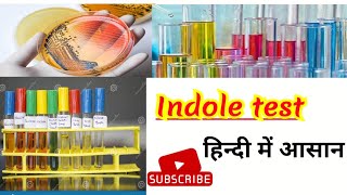 Indole test microbiology  Bacterial identification in hindi [upl. by Leahcimauhsoj]