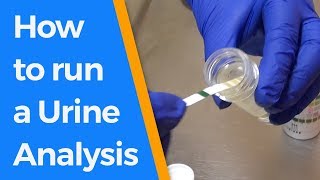 How to run a Urine Analysis [upl. by Derayne]