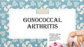 Gonococcal Arthritis Definition of gonococcal Arthritis  Causes of gonococcal Arthritis💯✨ [upl. by Yeltihw100]