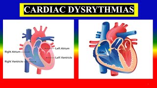 CARDIAC ARRHYTHMIA  DYSRHYTHMIA  anatomy  physiology  Define  Types  treatment [upl. by Savadove]