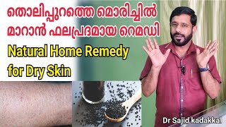 Easy Remedy for Dry Skin തൊലിപ്പുറത്തെ മൊരിച്ചിൽ മാറാൻ ഫലപ്രദമായ നാച്ചുറൽ ഹോം റെമഡി [upl. by Dlanod]