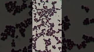 Gram Staining Insights Identifying Staphylococcus hominis as GPC in Singles Pairs and Clusters [upl. by Pasia]