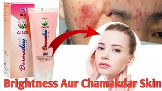 Dermadew Caloe Lotion hindi Review Iska Kam Kya Hai Side Effects Uses  benefits digitalmedilife [upl. by Phelips]