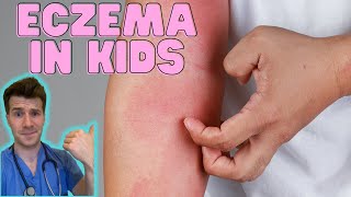 Everything you need to know about Eczema in kids Causes symptoms treatment amp home management [upl. by Oicnaneb]