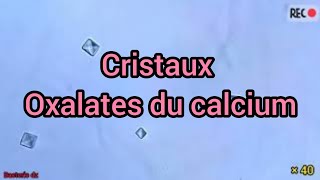 Cristaux doxalate du calcium [upl. by Maddalena]