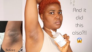 I Tried Glycolic Acid on my ArmpitUnderarm and it Did This Im SHOOK😱 [upl. by Ernesto]