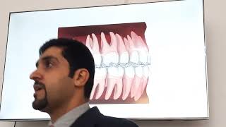 orthodontist etiology of malocclusion 1 [upl. by Akinirt571]