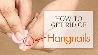 How to Get Rid of Hangnails Fast  Home Remedies for Hangnails Treatment [upl. by Jehiel45]