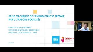 Endométriose  quels traitements en 2021  Webinar HCL [upl. by Nlocnil117]