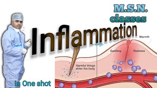 MSNwhat is InflammationMedical surgical nursingpathophysiology of inflammationsteps [upl. by Adaynek]