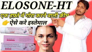 Hydroquinone tretinoin mometasone furoate cream  Elosone Ht cream useside effects in hindi [upl. by Arihsa285]