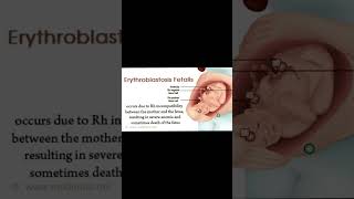 Erythroblastosis fetalis biology ncert bloodgroup shorts bodyfluids bloodpressure rhfactor [upl. by Neillij]