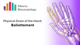 Rheumatology HAND exam Palpation for Joint Swelling [upl. by Sungam]