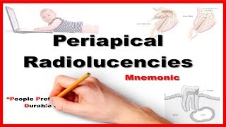 Periapical Radiolucencies  Mnemonic Series  23 [upl. by Rand]