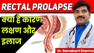 Rectal Prolapse Causes Symptoms and Treatmentdrramakantsharma7 [upl. by Batsheva150]