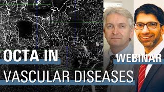 The Role of OCT Angiography in Retinal Vascular Diseases [upl. by Paulo]