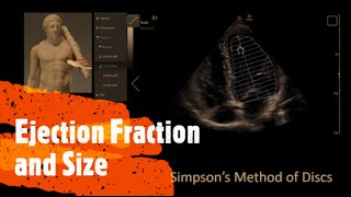 Measure Ejection Fraction EF and Ventricle Size Perioperative amp Critical Care ECHO  POCUS [upl. by Warford]