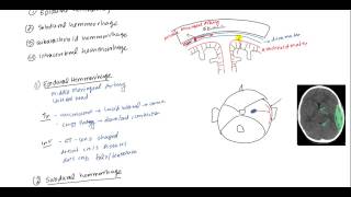 Epidural Hematoma Subdural hematoma Subarachnoid hematoma Intracerebral hemorrhage [upl. by Yecam]