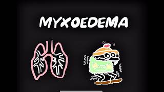 Myxoedema Coma CauseSymptoms Treatment [upl. by Aniroz]