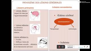 Traumatisme cranien Pr Daoud [upl. by Aehsat]