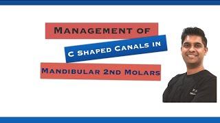 Endodontic Management of Cshape Canals [upl. by Niowtna]