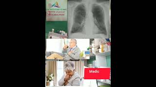 Bronchitis  শ্বাসযন্ত্রের সমস্যা  Acute Bronchitis  chronic Bronchitis [upl. by Airetahs801]