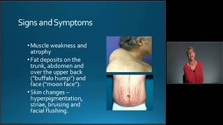 MedicalSurgical Nursing Exam Review Endocrine Disorders  MEDED [upl. by Enidanreb478]