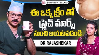 Dr Rajasekhar About Stretch Marks Removal Cream  Sriroop Cosmetic Clinic  Dr Rajasekhar [upl. by Faus464]