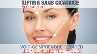 Médecine esthétique  lifting léger et discret sans marque ni cicatrice [upl. by Eyahc]