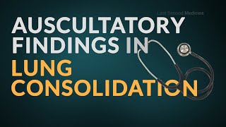 Auscultation Findings in Lung Consolidation  Revise These IMPORTANT FINDINGS [upl. by Inverson684]