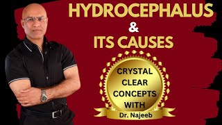 Causes of Hydrocephalus  What is going on in the brain  Dr Najeeb [upl. by Dnalsor]