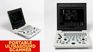 Portable Ultrasound Scanner Machines  ultrasound machine  ultrasound scanner  scanner machine [upl. by Sidell331]