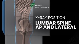 Radiographic Positioning Lumbar Spine AP and Lateral [upl. by Themis663]