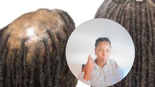 Mistakes You’re Making When Doing a Twist Out [upl. by Elik582]