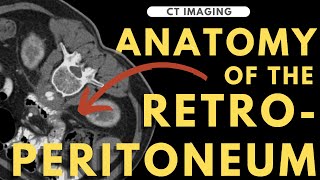 Retroperitoneal anatomy organs and spaces  Radiology anatomy part 1 prep  CT abdomen [upl. by Davidde188]