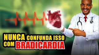 O QUE NAO É BRADICARDIA [upl. by Nodarse]