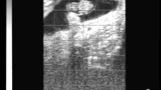 Bovine pregnancy 40 days with EasiScan ultrasoundwmv [upl. by Ham]