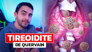 Tireoidite Subaguda De Quervain │ MEDICINA RESUMIDA [upl. by Marsden]