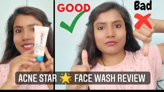 Acne star 🌟 Face wash Honest Review Acne star face wash Review in Hindi missdeepika [upl. by Short]