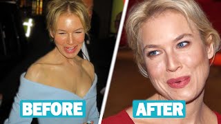 Renée Zellweger Plastic Surgery and Weight Loss Journey [upl. by June606]