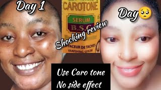 CAROTONE Serum  Shocking 😲 ReviewBrightening 🧖‍♀️Repair Soothing Oilcarotoneserum Review [upl. by Ahsie]