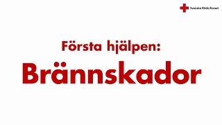 Första hjälpen vid brännskador [upl. by Ardna]