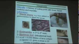 DrAzza Parasitology  Nematodes 6  Tissue Nematodes [upl. by Chloe]