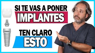 📌𝗜𝗡𝗙𝗢𝗥𝗠𝗔𝗖𝗜𝗢𝗡 𝗖𝗟𝗔𝗩𝗘 sobre la 𝗖𝗢𝗟𝗢𝗖𝗔𝗖𝗜𝗢𝗡 𝗜𝗠𝗣𝗟𝗔𝗡𝗧𝗘𝗦 dentales paso a paso explicada TE INTERESA 👌 [upl. by Elihu]