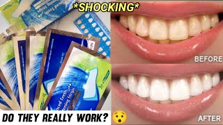 INSANE Urgent Teeth Whitening Strips  Teeth whitening at home [upl. by Adnohsor]